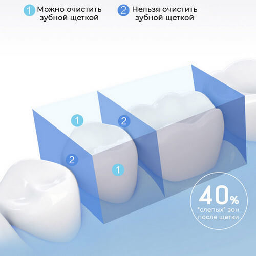 Ирригатор Xiaomi Soocas W3 Pro